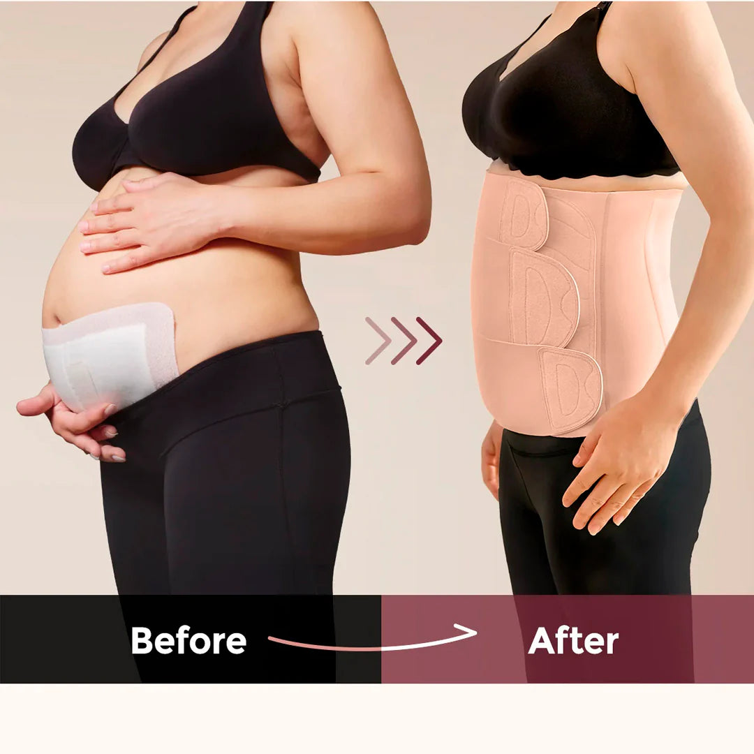 Faja Post Parto Ergo Wrap Momcozy